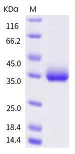 SARS-CoV-2 Spike Protein (RBD) (I472V) His-tag Protein