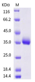 SARS-CoV-2 Spike Protein (RBD) (K378N) His-tag Protein