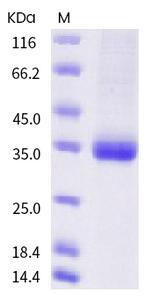 SARS-CoV-2 Spike Protein (RBD) (K417N) His-tag Protein