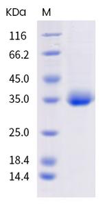 SARS-CoV-2 Spike Protein (RBD) (mutant) His-tag Protein