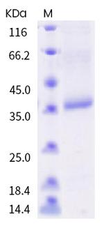 SARS-CoV-2 Spike Protein (RBD) (K458Q) His-tag Protein