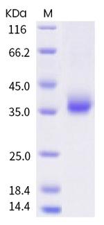 SARS-CoV-2 Spike Protein (RBD) (L452R) His-tag Protein