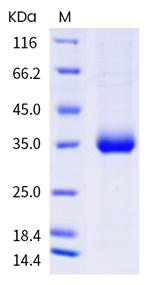 SARS-CoV-2 Spike Protein (RBD) (L455F) His-tag Protein