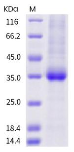 SARS-CoV-2 Spike Protein (RBD) (N370S) His-tag Protein