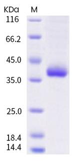 SARS-CoV-2 Spike Protein (RBD) (N439K) His-tag Protein