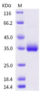 SARS-CoV-2 Spike Protein (RBD) (N440K) His-tag Protein