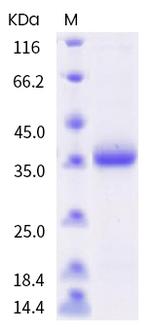 SARS-CoV-2 Spike Protein (RBD) (N481D) His-tag Protein