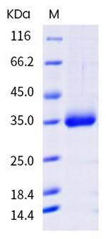 SARS-CoV-2 Spike Protein (RBD) (N487R) His-tag Protein