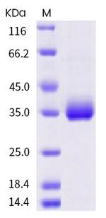 SARS-CoV-2 Spike Protein (RBD) (P337S) His-tag Protein