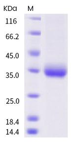SARS-CoV-2 Spike Protein (RBD) (P384L) His-tag Protein