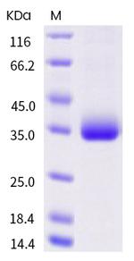 SARS-CoV-2 Spike Protein (RBD) (P479S) His-tag Protein