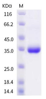 SARS-CoV-2 Spike Protein (RBD) (P499R) His-tag Protein