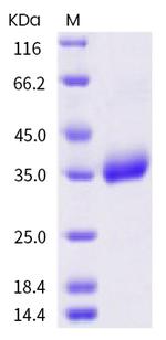 SARS-CoV-2 Spike Protein (RBD) (P521R) His-tag Protein