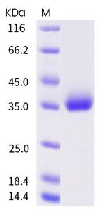 SARS-CoV-2 Spike Protein (RBD) (P521S) His-tag Protein