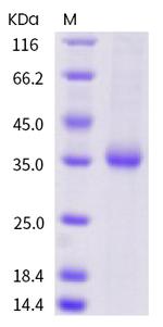 SARS-CoV-2 Spike Protein (RBD) (Q409E) His-tag Protein