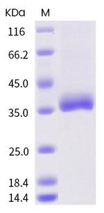 SARS-CoV-2 Spike Protein (RBD) (Q414E) His-tag Protein