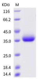 SARS-CoV-2 Spike Protein (RBD) (Q414R) His-tag Protein