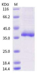 SARS-CoV-2 Spike Protein (RBD) (R408I) His-tag Protein