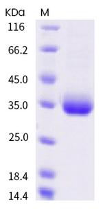 SARS-CoV-2 Spike Protein (RBD) (S359N) His-tag Protein