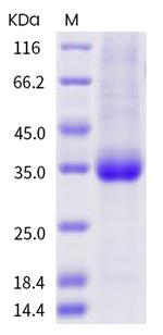 SARS-CoV-2 Spike Protein (RBD) (S477I) His-tag Protein