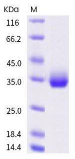 SARS-CoV-2 Spike Protein (RBD) (S477N) His-tag Protein