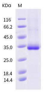 SARS-CoV-2 Spike Protein (RBD) (S477R) His-tag Protein