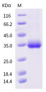 SARS-CoV-2 Spike Protein (RBD) (S494P) His-tag Protein