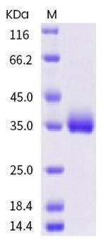 SARS-CoV-2 Spike Protein (RBD) (T385A) His-tag Protein