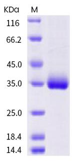 SARS-CoV-2 Spike Protein (RBD) (T393P) His-tag Protein