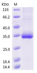 SARS-CoV-2 Spike Protein (RBD) (T478I) His-tag Protein