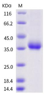 SARS-CoV-2 Spike Protein (RBD) (V395I) His-tag Protein