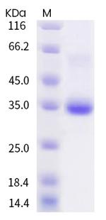 SARS-CoV-2 Spike Protein (RBD) (V445F) His-tag Protein