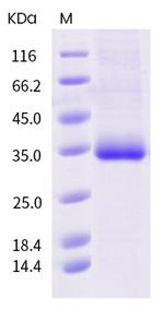 SARS-CoV-2 Spike Protein (RBD) (V483I) His-tag Protein