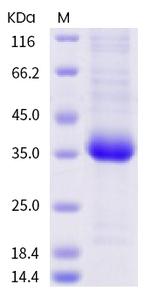 SARS-CoV-2 Spike Protein (RBD) (V503F) His-tag Protein