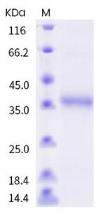 SARS-CoV-2 Spike Protein (RBD) (Y505C) His-tag Protein