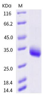 SARS-CoV-2 Spike Protein (RBD) (Y508H) His-tag Protein