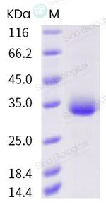 SARS-CoV-2 Spike Protein (RBD) (A435S) His-tag Protein