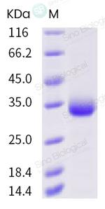 SARS-CoV-2 Spike Protein (RBD) (K458R) His-tag Protein