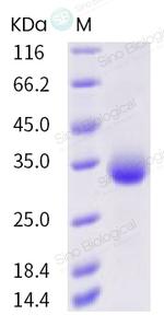SARS-CoV-2 Spike Protein (RBD) (N354D) His-tag Protein