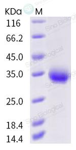 SARS-CoV-2 Spike Protein (RBD) (V367F) His-tag Protein