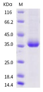 SARS-CoV-2 Spike Protein (RBD) (W436R) His-tag Protein
