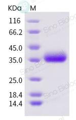 SARS-CoV-2 Spike Protein (RBD) His-tag Protein