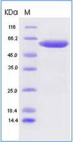 SARS-CoV-2 Spike Protein (RBD) Fc Chimera Protein