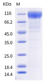 SARS-CoV-2 Spike Protein S1 (mutant) His-tag Protein