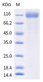 SARS-CoV-2 Spike Protein S1 (P.1) His-tag Protein