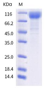 SARS-CoV-2 Spike Protein S1 (mutant) His-tag Protein
