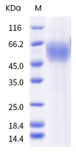 SARS-CoV-2 Spike Protein S1 NTD (B.1.351) His-tag Protein