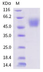SARS-CoV-2 Spike Protein S1 His-Avi Tag Protein
