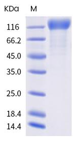 SARS-CoV-2 Spike Protein S1 (mutant) His-tag Protein
