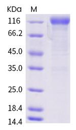 SARS-CoV-2 Spike Protein S1 (D614G) Fc Chimera Protein
